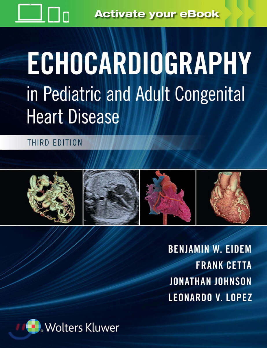 Echocardiography in Pediatric and Adult Congenital Heart Disease, 3/E