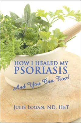 How I Healed My Psoriasis: And You Can Too!