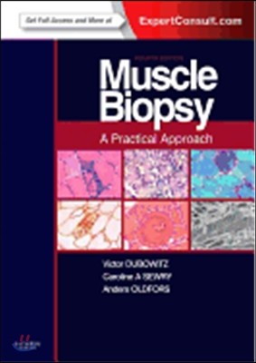 Muscle Biopsy