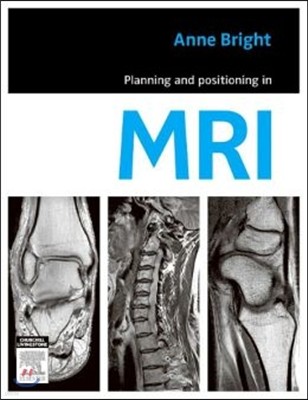 Planning and Positioning in MRI