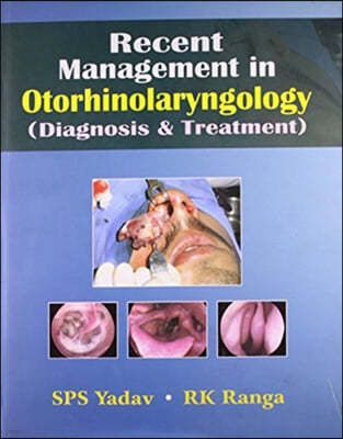 Recent Management in Otorhinolaryngology: (diagnosis & Treatment)