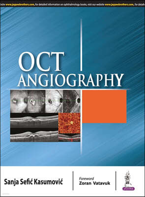 OCT Angiography
