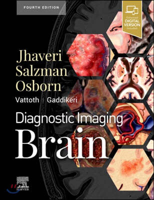 Diagnostic Imaging: Brain, 4/E