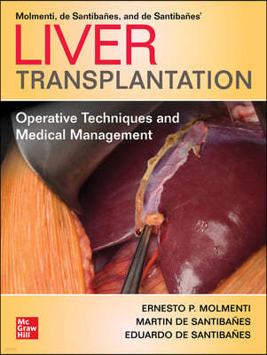 Liver Transplantation: Operative Techniques and Medical Management