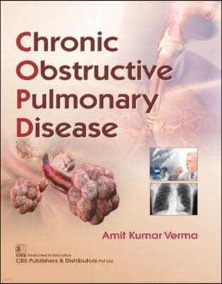 Chronic Obstructive Pulmonary Disease