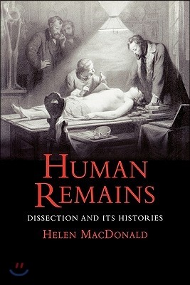 Human Remains