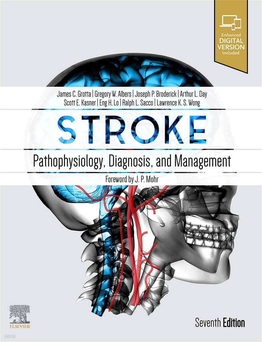 Stroke