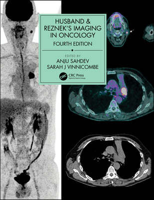 Husband & Reznek's Imaging in Oncology