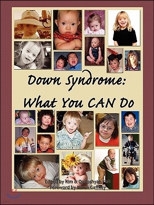 Down Syndrome: What You CAN Do