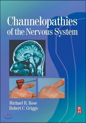 Channelopathies of the Nervous System