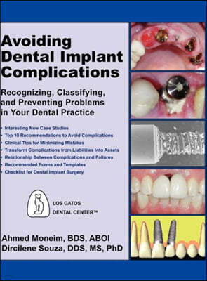 Avoiding Dental Implant Complications