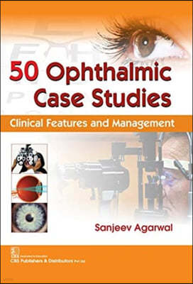 50 Ophthalmic Case Studies: Clinical Features and Management