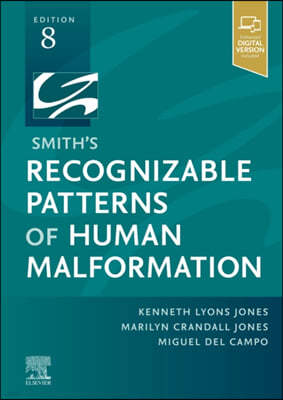 Smith's Recognizable Patterns of Human Malformation, 8/E