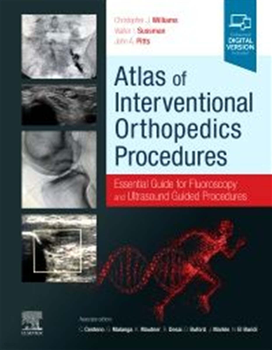 Atlas of Interventional Orthopedics Procedures: Essential Guide for Fluoroscopy and Ultrasound Guided Procedures