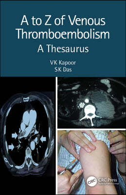 to Z of Venous Thromboembolism