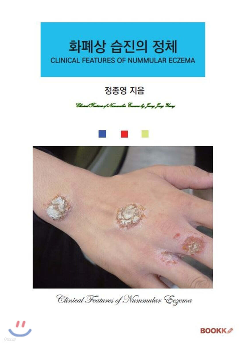 화폐상 습진의 정체 (흑백판)