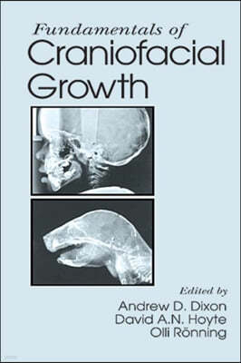 Fundamentals of Craniofacial Growth