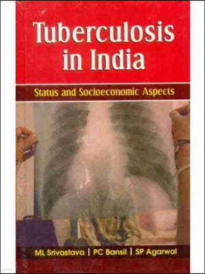 Tuberculosis in India: Status and Socioeconomic Aspects