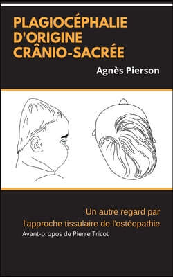 plagiocephalie d'origine cranio-sacree: un autre regard par l'approche tissulaire de l'osteopathie