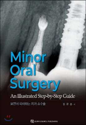 Minor Oral Surgery 鼭 ϴ ġ Ҽ