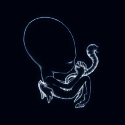 Sigur Ros — Agaetis Byrjun 앨범 커버