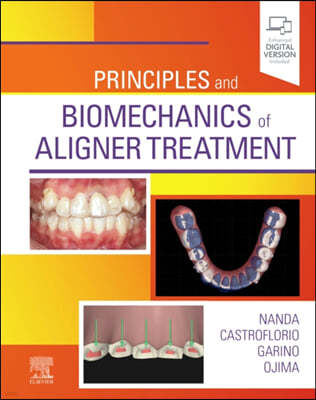 Principles and Biomechanics of Aligner Treatment