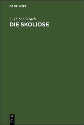 Die Skoliose: Anleitung Zur Beurtheilung Und Behandlung Ruckgratsverkrummungen Fur Praktische Aerzte