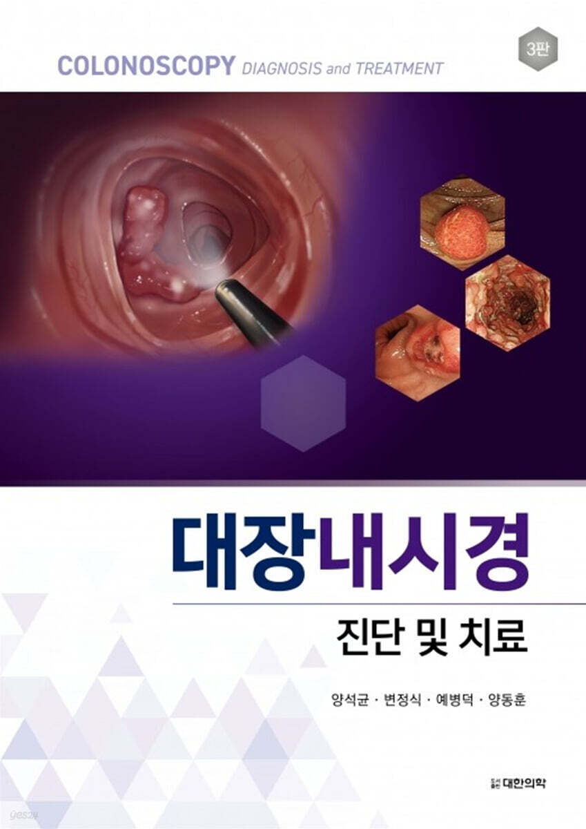 대장내시경 진단 및 치료