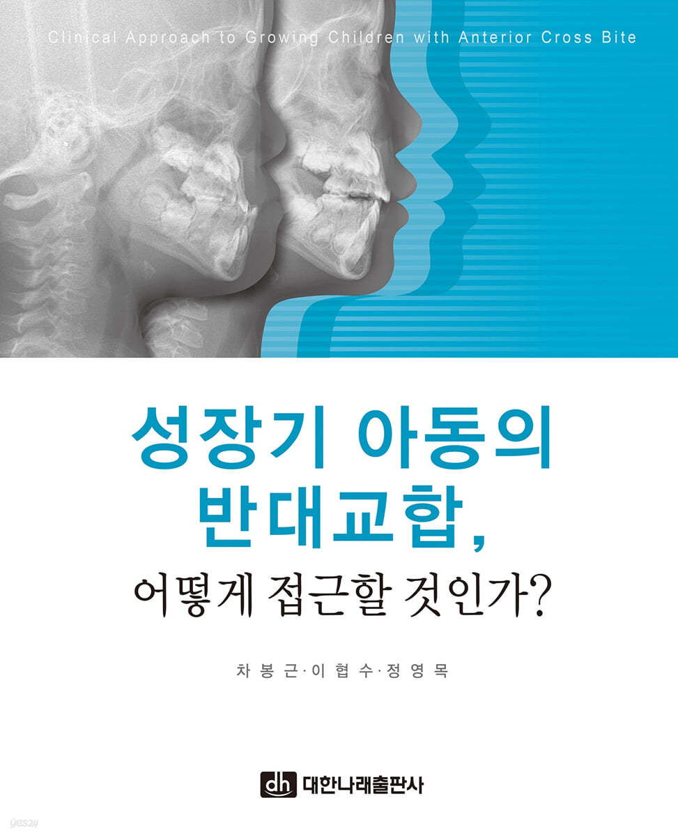 성장기 아동의 반대교합, 어떻게 접근할 것인가?