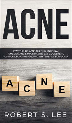 Acne: How to Cure Acne through Natural Remedies and Simple Habits. Say Goodbye to Pustules, Blackheads and Whiteheads for Go