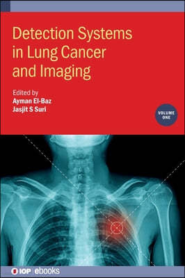 Detection Systems in Lung Cancer and Imaging, Volume 1