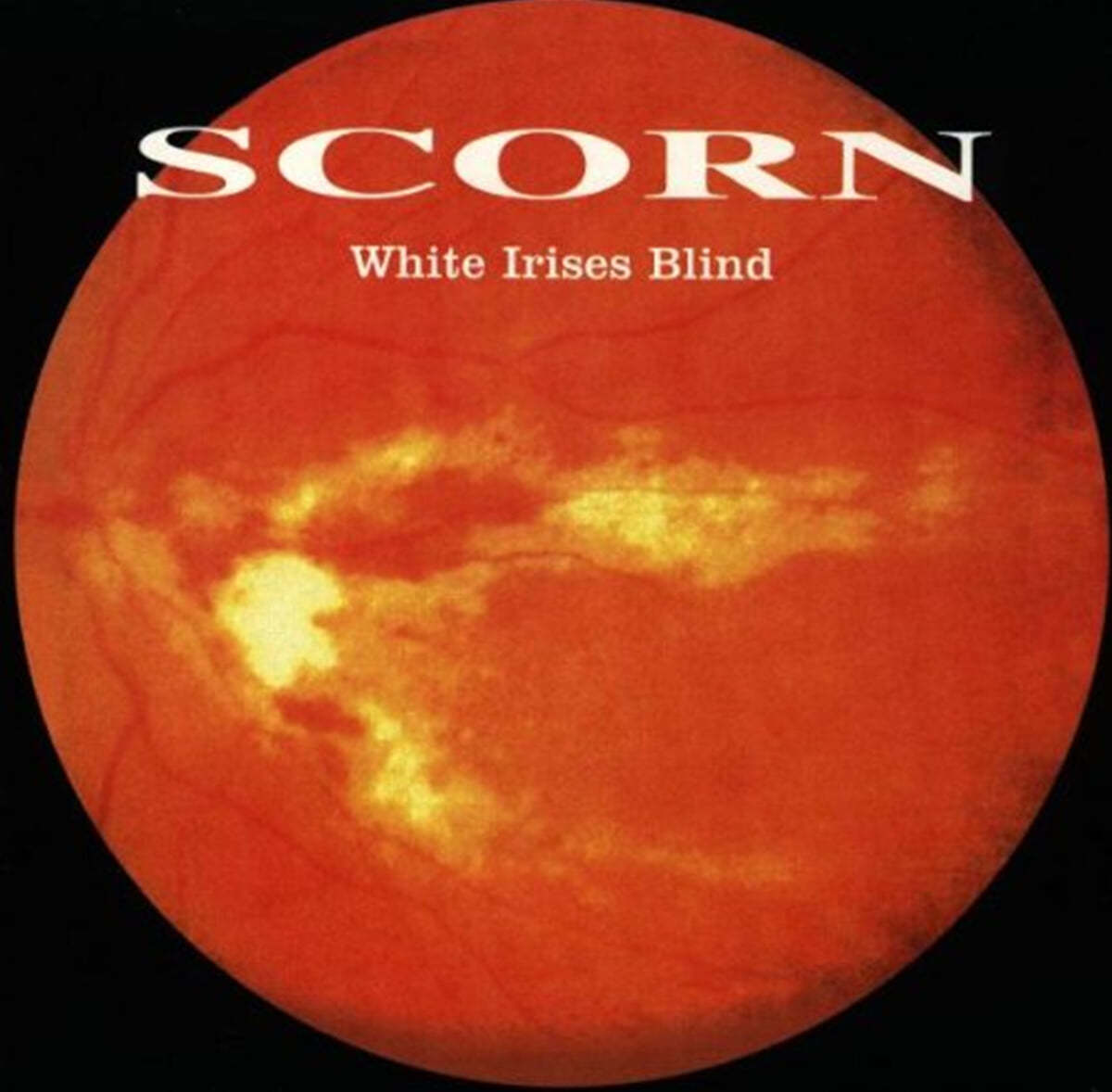 Scorn (스콘) - White Irises Blind 