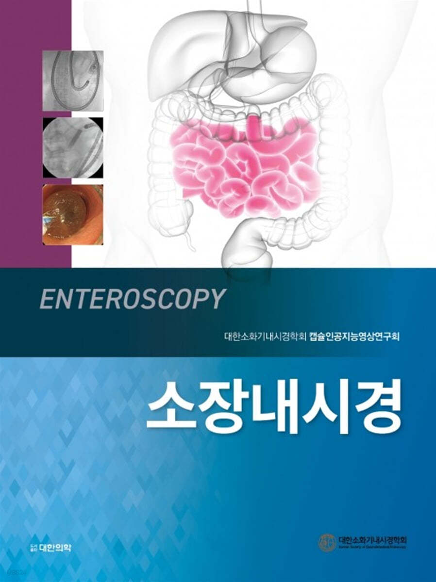 소장내시경