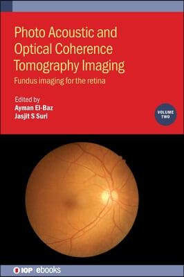 Photo Acoustic and Optical Coherence Tomography Imaging, Volume 2: Fundus imaging for the retina