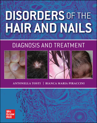 Disorders of the Hair and Nail: Diagnosis and Treatment