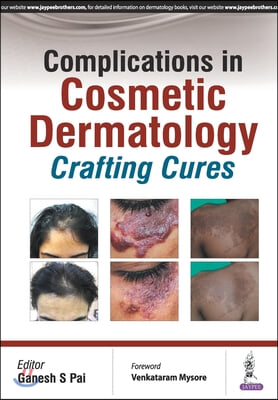 Complications in Cosmetic Dermatology: Crafting Cures