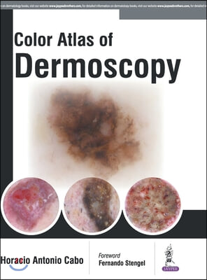 Color Atlas of Dermoscopy