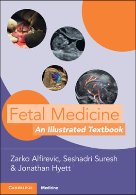 Fetal Medicine: An Illustrated Textbook