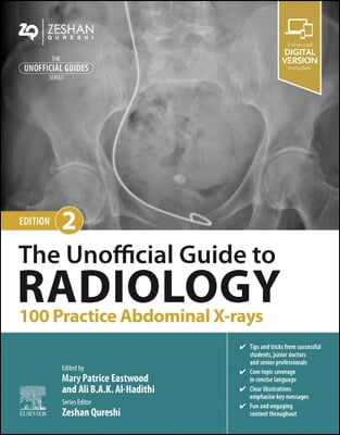 The Unofficial Guide to Radiology: 100 Practice Abdominal X-Rays