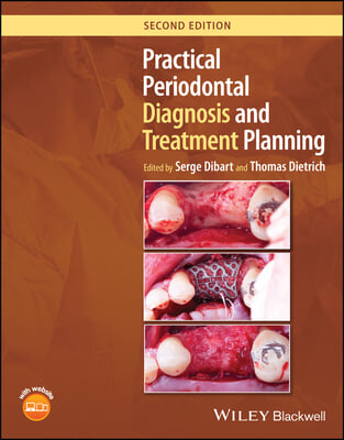 Practical Periodontal Diagnosis and Treatment Planning