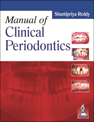 Manual of Clinical Periodontics / Essentials of Clinical Periodontology &amp; Periodontics