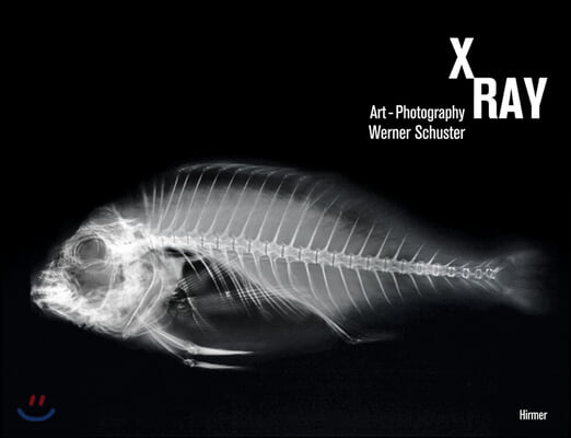 X-ray