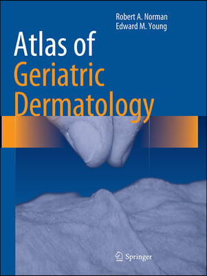 Atlas of Geriatric Dermatology