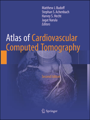 Atlas of Cardiovascular Computed Tomography