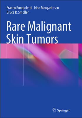 Rare Malignant Skin Tumors