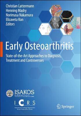 Early Osteoarthritis: State-Of-The-Art Approaches to Diagnosis, Treatment and Controversies