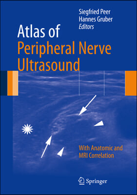 Atlas of Peripheral Nerve Ultrasound: With Anatomic and MRI Correlation