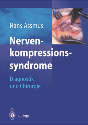 Nerven-Kompressions-Syndrome