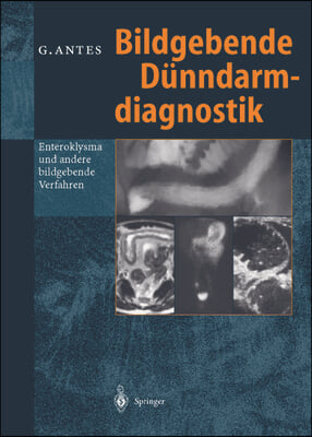 Bildgebende Dunndarmdiagnostik