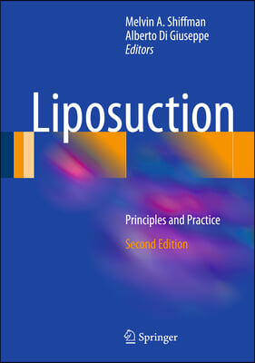 Liposuction: Principles and Practice